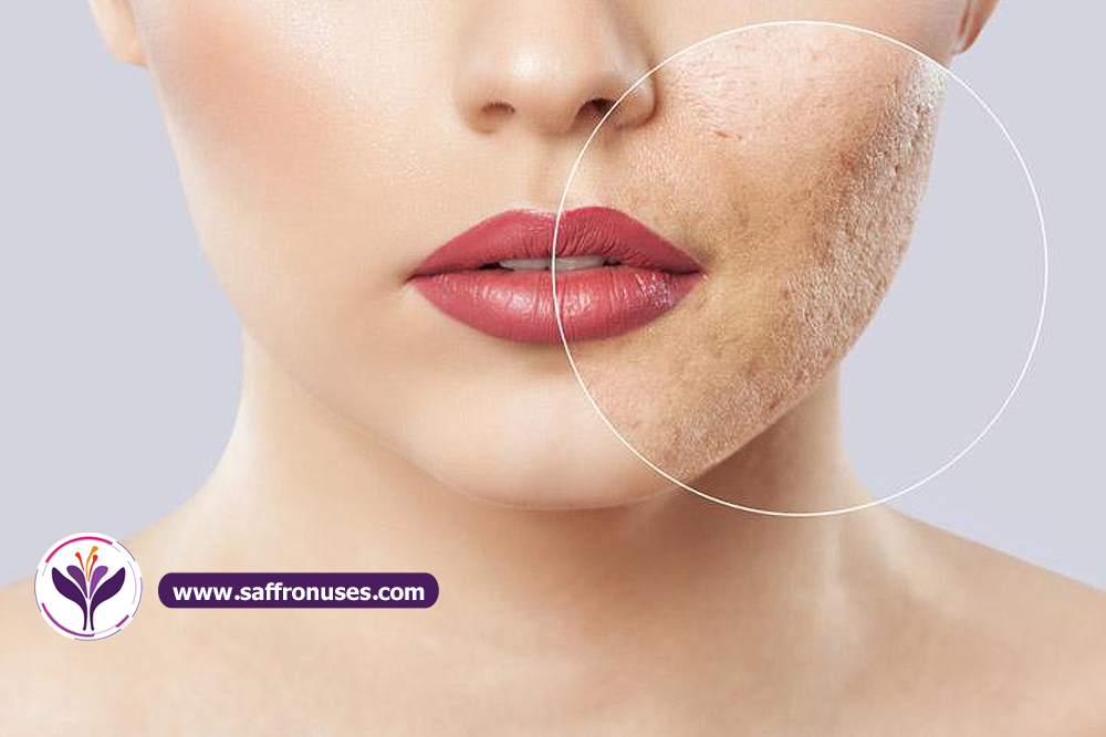 Can skin blemishes be treated