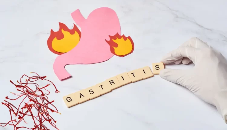 Saffron, a natural remedy for gastritis